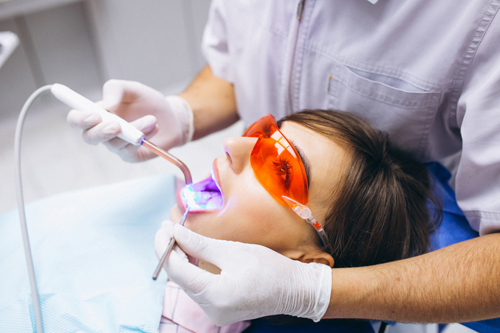 Proceso de blanqueamiento dental con tecnología LED