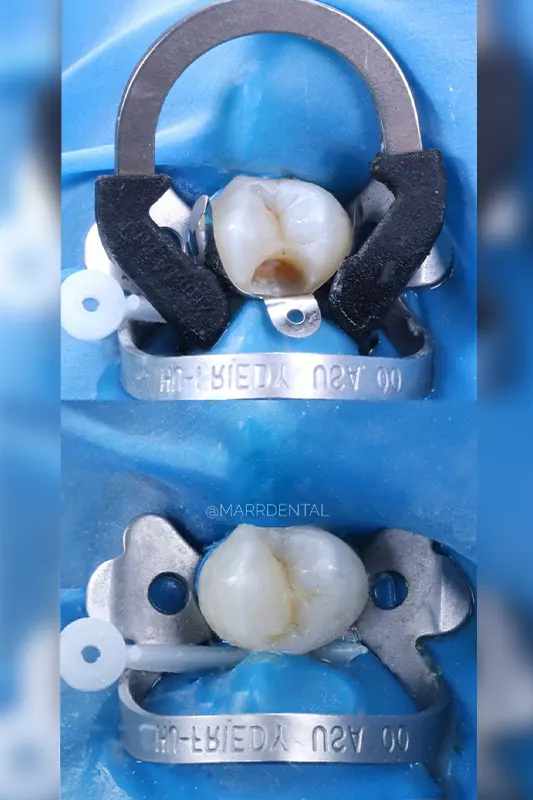 Img-MarrDental-Servicio-Odontología_general_Medellín Img-MarrDental-Servicio-Odontología_general_Medellín