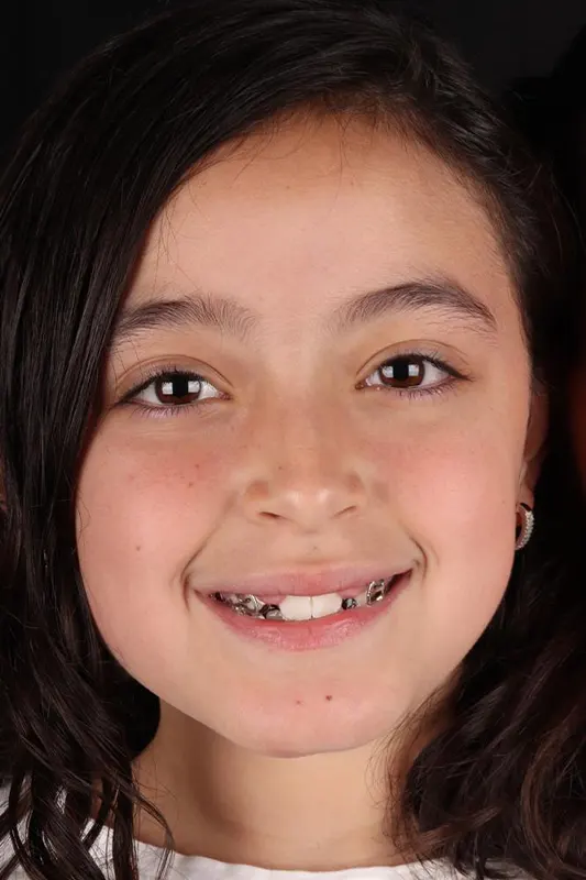 Img-MarrDental-Servicio-Odontopediatría