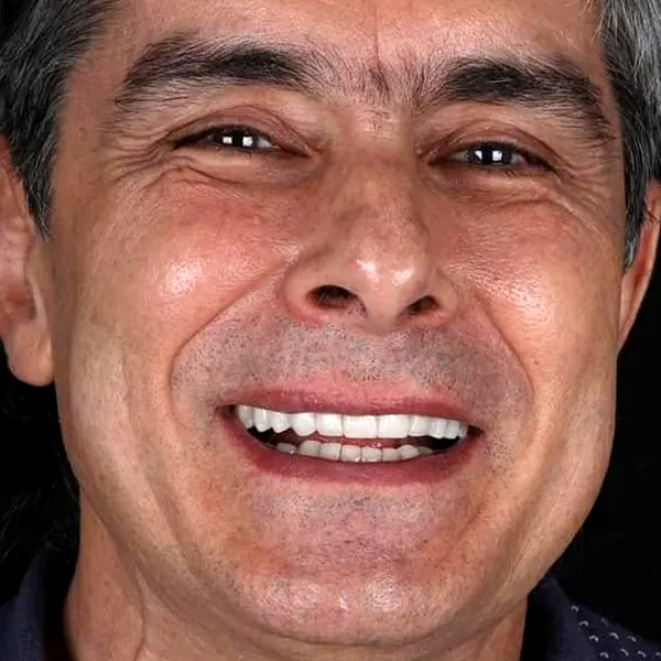 Img-Marr_Dental-Card-Servicio-Rehabilitación_Oral