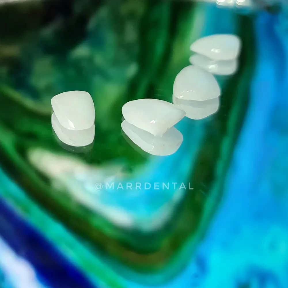 Img-Marr_Dental-Servicios-Tratamientos-2