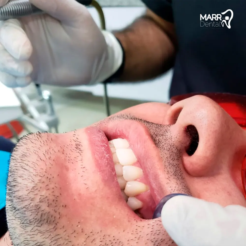 Img-Marr_Dental-Servicios-Tratamientos-5