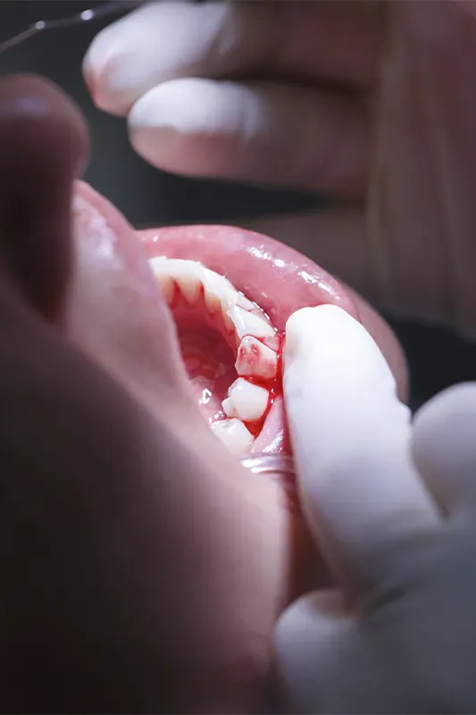 img-odontologia-periodoncia-medellin-1