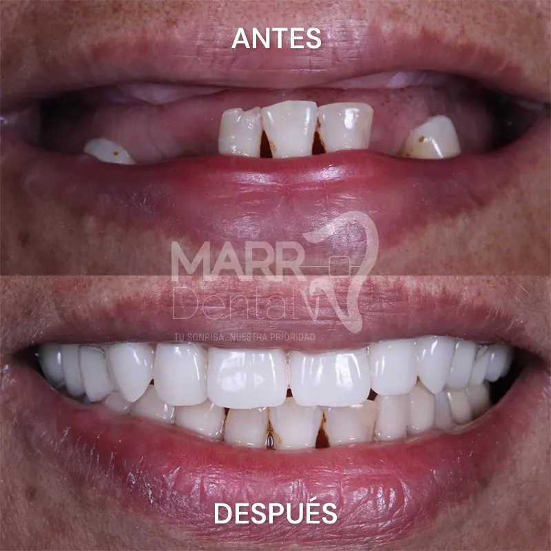 Rehabilitación_Oral-1